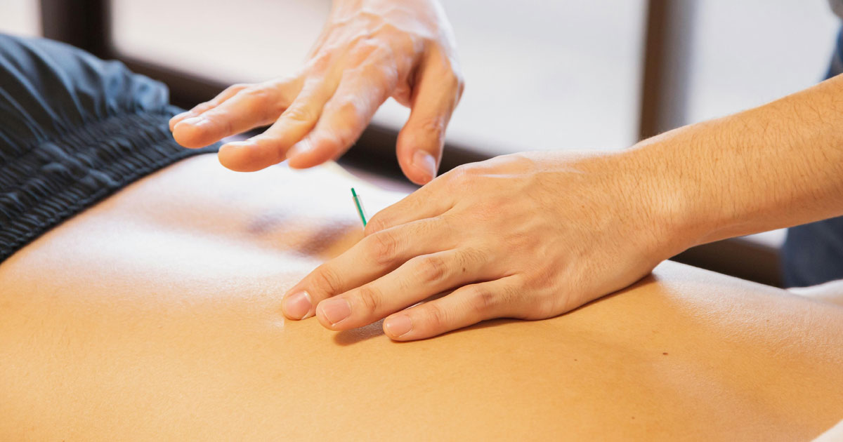 Our clinic is dedicated to providing the most effective and precise treatments for lower back pain. One therapy we offer is dry needling, a technique that can help alleviate pain and improve mobility.